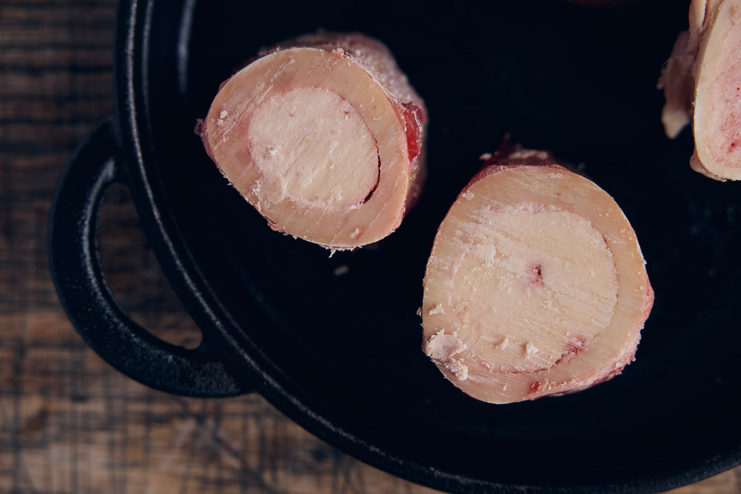 Bone Marrow Rings